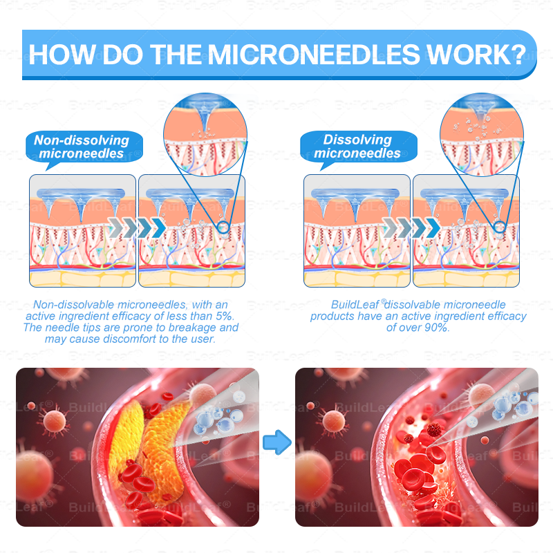FDA Store·𝐁𝐮𝐢𝐥𝗱𝐋𝐞𝐚𝐟®𝐒𝐥𝐢𝐦 & 𝐅𝐢𝐫𝐦 𝐍𝐚𝐧𝐨 𝐌𝐢𝐜𝐫𝐨𝐧𝐞𝐞𝐝𝐥𝐞 𝐏𝐚𝐭𝐜𝐡 𝐰𝐢𝐭𝐡 𝐌𝐨𝐫𝐢𝐧𝐠𝐚, 𝐎𝐦𝐞𝐠𝐚-𝟑, 𝐂𝐨𝐥𝐥𝐚𝐠𝐞𝐧 𝐏𝐞𝐩𝐭𝐢𝐝𝐞𝐬, 𝐍𝐀𝐃 & 𝐍𝐌𝐍 𝐟𝐨𝐫 𝐎𝐛𝐞𝐬𝐢𝐭𝐲, 𝐂𝐚𝐫𝐝𝐢𝐨𝐯𝐚𝐬𝐜𝐮𝐥𝐚𝐫 𝐃𝐢𝐬𝐞𝐚𝐬𝐞, 𝐃𝐢𝐚𝐛𝐞𝐭𝐞𝐬, 𝐒𝐥𝐞𝐞𝐩 𝐀𝐩𝐧𝐞𝐚, 𝐉𝐨𝐢𝐧𝐭 𝐏𝐫𝐨𝐛𝐥𝐞𝐦𝐬, 𝐒𝐤𝐢𝐧 𝐅𝐢𝐫𝐦𝐢𝐧𝐠, 𝐀𝐧𝐭𝐢-𝐀𝐠𝐢𝐧𝐠, 𝐚𝐧𝐝 𝐌𝐨𝐫𝐞