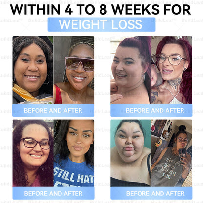 "Only 10 packs left — grab this exclusive upsell with an extra 30% OFF for faster slimming & firming in just 1–4 weeks!𝑩𝒖𝐢𝒍𝒅𝑳𝒆𝐚𝒇®"